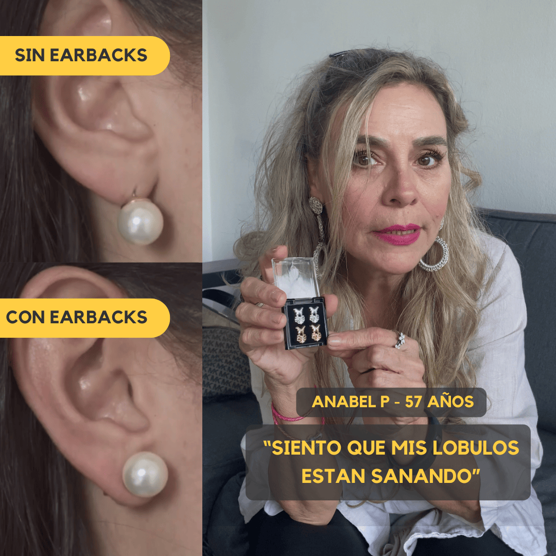 Earbacks Metuvi®